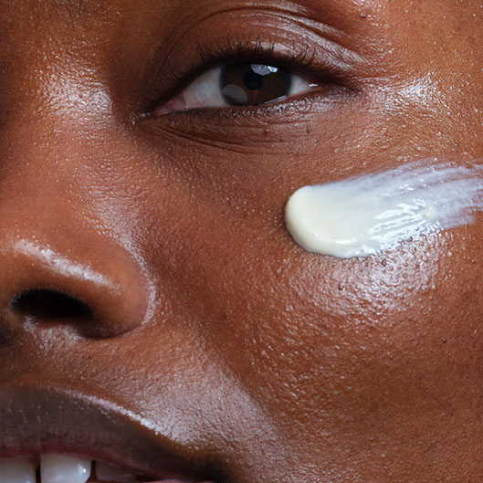 dehydrated skin